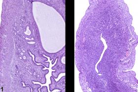 Image of atrophy in the uterus from a female B6C3F1 mouse in a subchronic study
