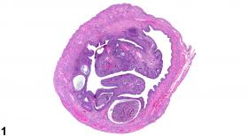 Image of hyperplasia, cystic (CEH) in the uterus from a female Sprague-Dawley rat in a chronic study