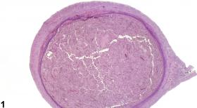 Image of metaplasia, squamous in the uterus from a female Sprague-Dawley rat in a chronic study