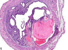 Image of thrombus in the uterus from a female B6C3F1 mouse in a chronic study