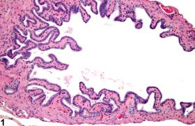 Image of hyperplasia in the gallbladder epithelium from a male  B6C3F1 mouse in a chronic study