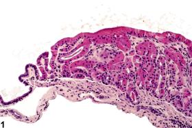 Image of hyaline droplet accumulation in the gallbladder from a male  B6C3F1 mouse in a chronic study