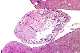 Image of inflammation in the gallbladder from a female B6C3F1 mouse in a chronic study