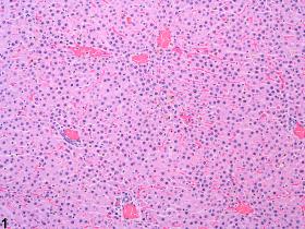 Image of atrophy in the liver from a female F344/N rat in a subchronic study