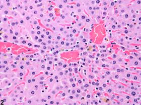 liver - Atrophy - Nonneoplastic Lesion Atlas