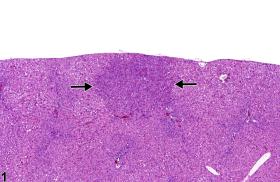 Image of basophilic focus in the liver from a male  F344/N rat in a subchronic study