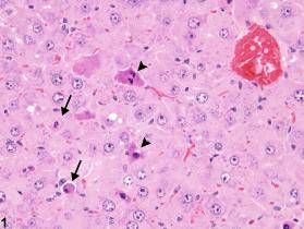Image of apoptosis in the liver from a male B6C3F1/N mouse in a chronic study
