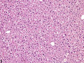 Image of glycogen accumulation in the liver from a female B6C3F1 mouse in a chronic study