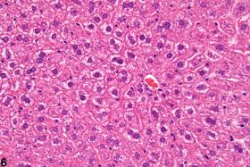 Liver, Hepatocyte - Hypertrophy - Nonneoplastic Lesion Atlas