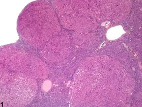 Image of hyperplasia, nodular in the liver from a female Harlan Sprague-Dawley rat in a chronic study
