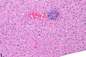 Image of inflammation in the liver from a female B6C3F1 mouse in a subchronic study