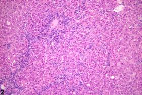 Liver, Oval Cell - Hyperplasia - Nonneoplastic Lesion Atlas