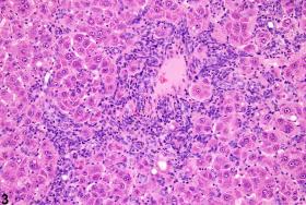 Liver, Oval Cell - Hyperplasia - Nonneoplastic Lesion Atlas