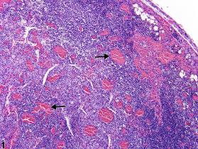 Image of congestion in the lymph node from a female B6C3F1/N mouse in a chronic study