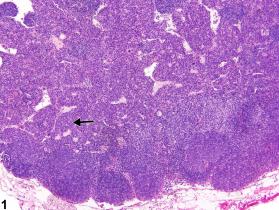 Image of hyperplasia, plasma cell in the lymph node from a female B6C3F1/N mouse in a chronic study