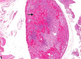 Image of sinus erythrocytosis in the lymph node from a female B6C3F1/N mouse in a chronic study