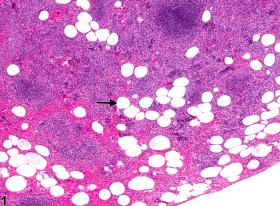 Image of adipocyte metaplasia in the spleen from a female F344/N rat in a chronic study