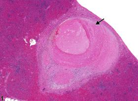Image of necrosis in the spleen from a male F344/N rat in a chronic study