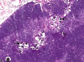 Image of mineralization in the thymus from a male B6C3F1/N mouse in a chronic study