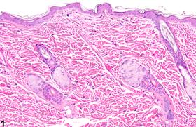 Image of atrophy (normal comparison) in the skin from a female F344/N rat in an acute study
