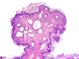Image of fibroadnexal hamartoma in the skin from a female F344/N rat in a chronic study