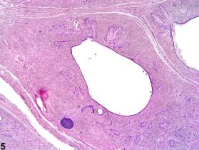 Skin - Fibroadnexal Hamartoma - Nonneoplastic Lesion Atlas