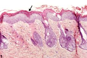 Image of hyperkeratosis in the skin from a male F344/N rat in a subchronic study