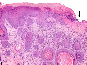 Image of ulcer in the skin from a male B6C3F1 mouse in a chronic study