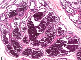 Image of mineralization in the prostate from a male Osborne-Mendel rat in a chronic study