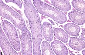 Image of atypical residual bodies in the testis from a male B6C3F1 mouse in a subchronic study