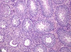 Image of interstitial cell vacuolation in the testis from a male FVB/N mouse in a chronic study