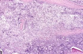 Image of inflammation in the bone from a male F344/N rat in a chronic study