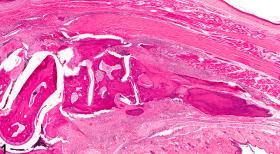 Image of joint inflammation in the bone from a male B6C3F1/N mouse in a chronic study