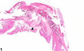 Image of necrosis in the bone from a male B6C3F1/N mouse in a chronic study