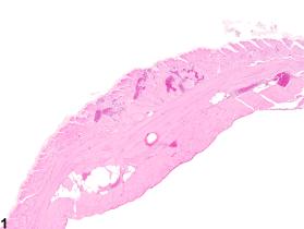 Image of angiectasis in the skeletal muscle from a male B6C3F1/N mouse in a chronic study