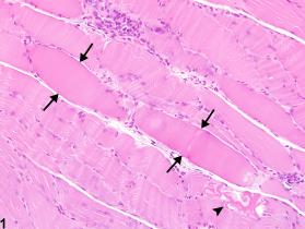 Image of degeneration in the skeletal muscle from a male Harlan Sprague-Dawley rat in a subchronic study
