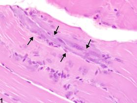 Image of regeneration in the skeletal muscle from a male Harlan Sprague-Dawley rat in a subchronic study