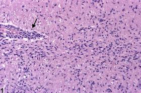 Microglial Cells Histology