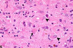 Microglial Cells Histology