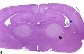 Brain - Necrosis - Nonneoplastic Lesion Atlas