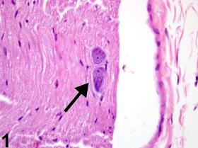 Image of ectopic neuron in the nerve from a male Harlan Sprague-Dawley rat in a subchronic study