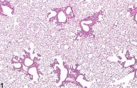 Image of alveolar/bronchiolar epithelial hyperplasia in the lung from a male B6C3F1/N mouse in a chronic study
