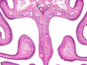 Image of hyperplasia in the nose, olfactory epithelium, glands from a male B6C3F1/N mouse in a chronic study