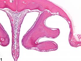 Image of hyperostosis in the nose, turbinate from a male B6C3F1/N mouse in a chronic study