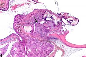 Ear - Inflammation - Nonneoplastic Lesion Atlas