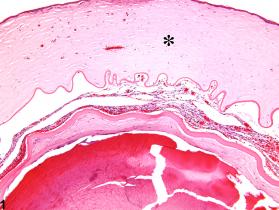 Image of cornea edema in the eye from a female F344/N rat in a chronic study