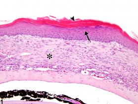 Image of cornea hyperplasia, squamous in the eye from a male B6C3F1 mouse in a chronic study