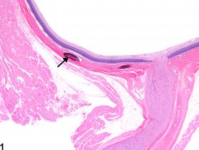 Image of sclera metaplasia, osseous in the eye from a male F344/N rat in a chronic study