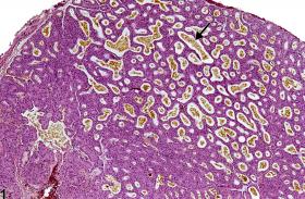 Image of pigment in the Harderian gland from a female F344/N rat in a subchronic study