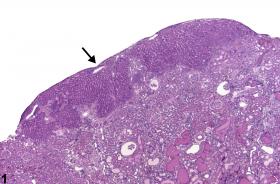 Image of ectopic liver tissue in the kidney from a female F344/N rat in a chronic study